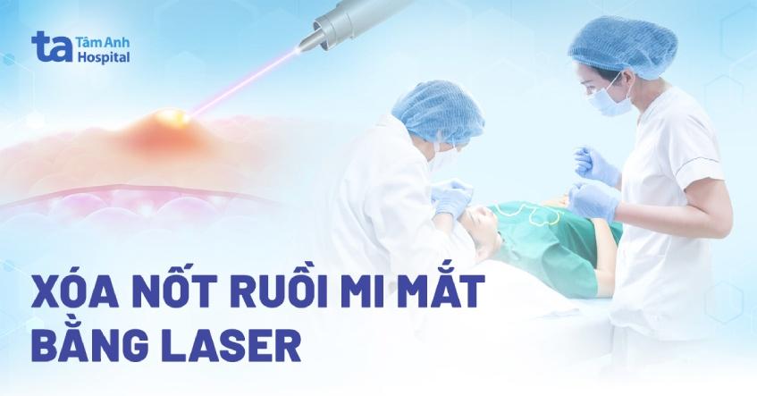 Nốt ruồi dưới mắt trái nam, nốt ruồi dưới mắt phải nam mang ý nghĩa gì?