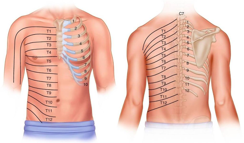 Cách chữa đau thần kinh liên sườn tại nhà hiệu quả, dễ thực hiện 1