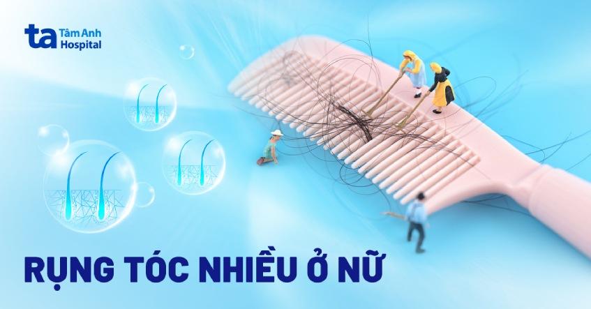 Rụng tóc nhiều ở nữ giới: Nguyên nhân, dấu hiệu, chẩn đoán và ngăn ngừa